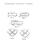 ENDOLUMINAL FILTER diagram and image