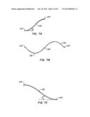 ENDOLUMINAL FILTER diagram and image