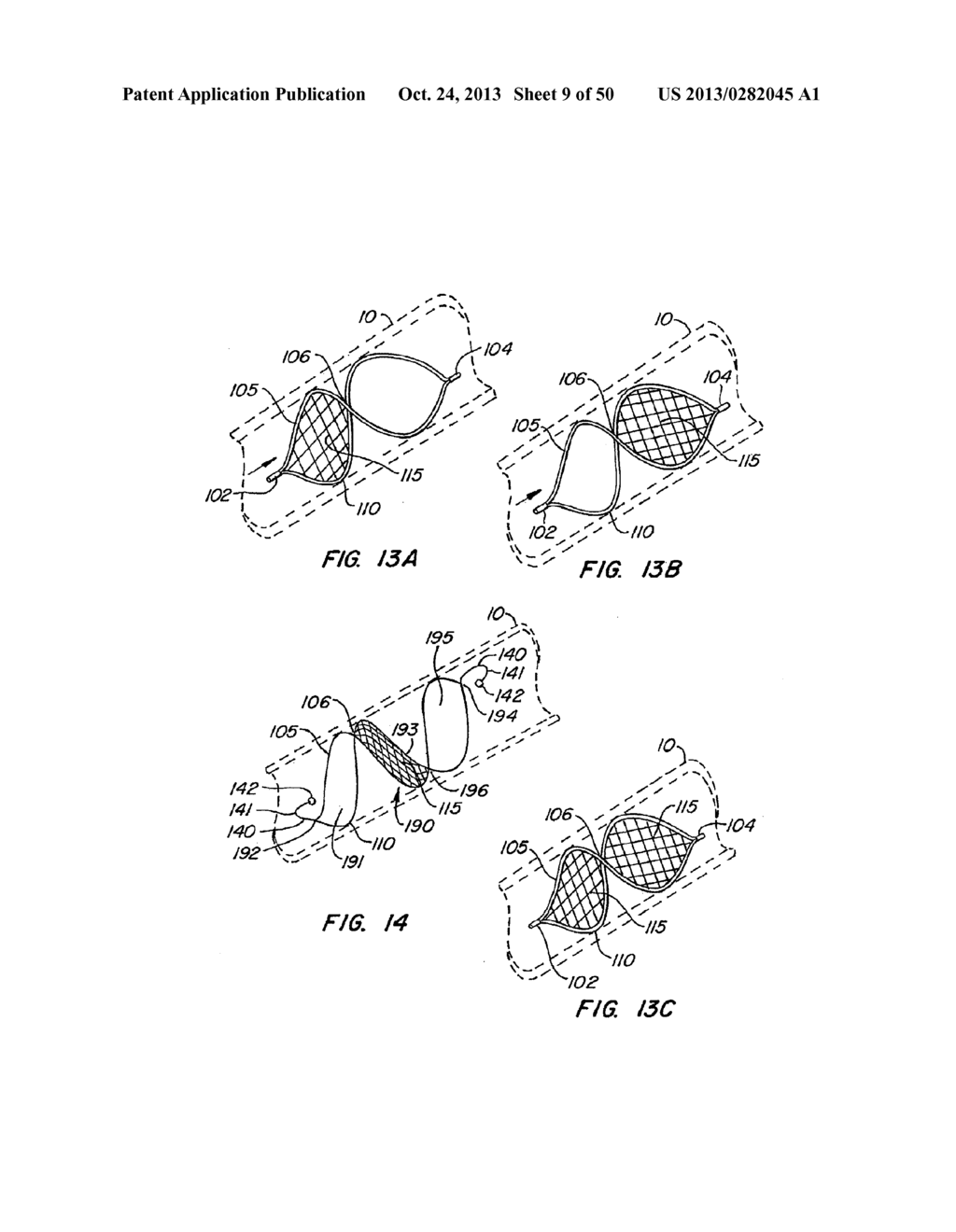 ENDOLUMINAL FILTER - diagram, schematic, and image 10