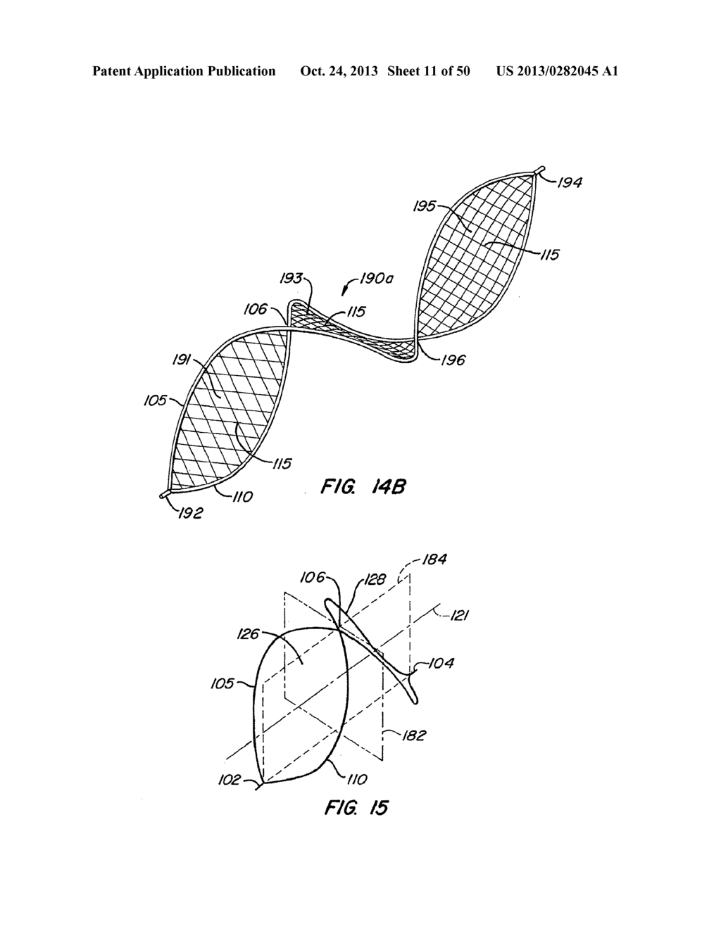 ENDOLUMINAL FILTER - diagram, schematic, and image 12