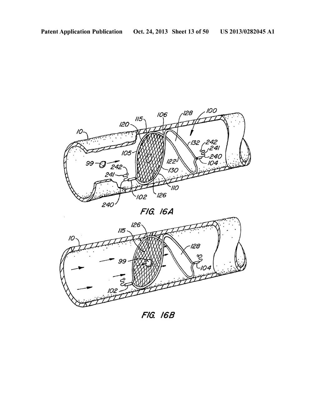 ENDOLUMINAL FILTER - diagram, schematic, and image 14