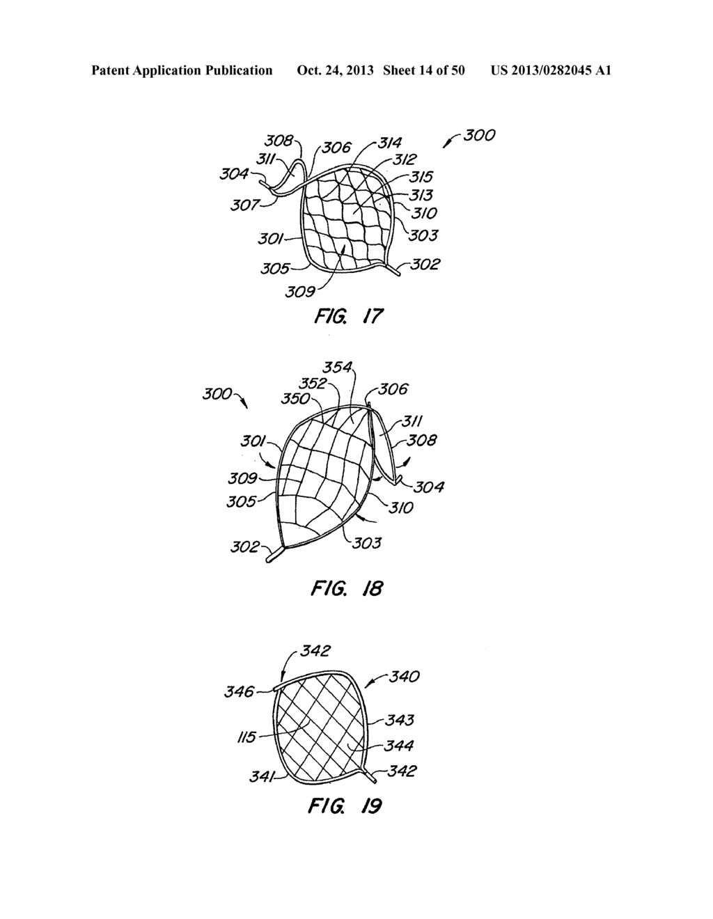 ENDOLUMINAL FILTER - diagram, schematic, and image 15