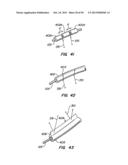 ENDOLUMINAL FILTER diagram and image