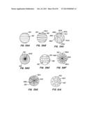 ENDOLUMINAL FILTER diagram and image