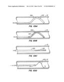 ENDOLUMINAL FILTER diagram and image