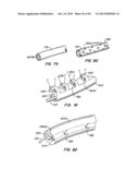 ENDOLUMINAL FILTER diagram and image