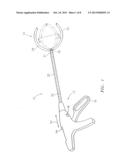 EXTRALUMINAL SEALANT APPLICATOR AND METHOD diagram and image