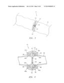 EXTRALUMINAL SEALANT APPLICATOR AND METHOD diagram and image