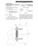 Dynamic Stabilization Systems And Devices For A Spine diagram and image