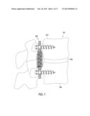 Dynamic Stabilization Systems And Devices For A Spine diagram and image