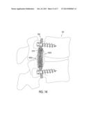 Dynamic Stabilization Systems And Devices For A Spine diagram and image