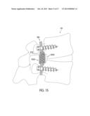 Dynamic Stabilization Systems And Devices For A Spine diagram and image