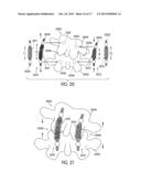 Dynamic Stabilization Systems And Devices For A Spine diagram and image