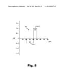 Channel-Specific Adjustment of Sound Processing Strategies Based on     Electrode Impedance diagram and image