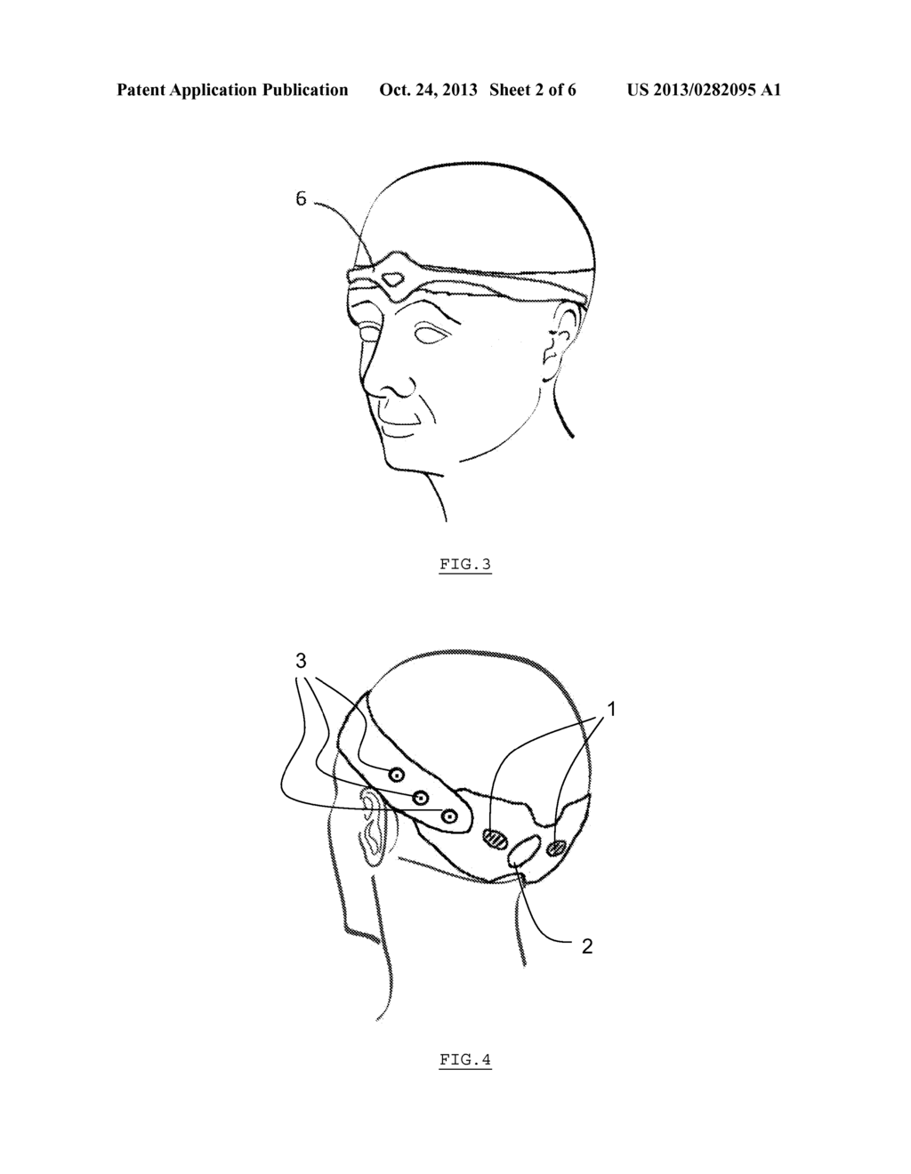 Headband for External Occipital Neurostimulation - diagram, schematic, and image 03