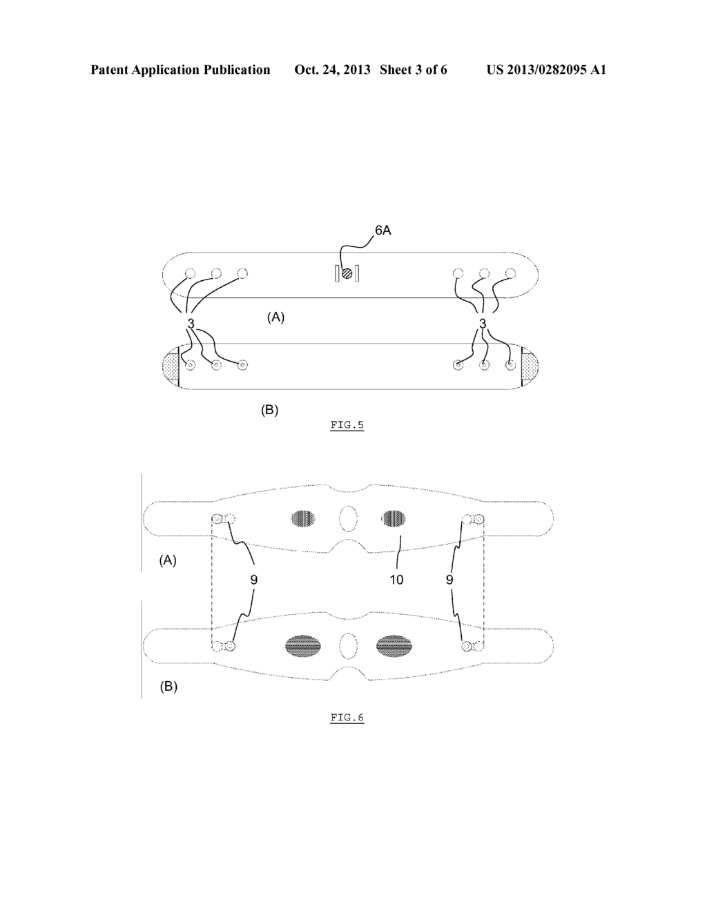 Headband for External Occipital Neurostimulation - diagram, schematic, and image 04