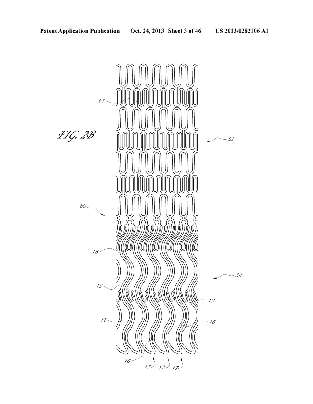 SUPPORT FOR TREATING VASCULAR BIFURCATIONS - diagram, schematic, and image 04