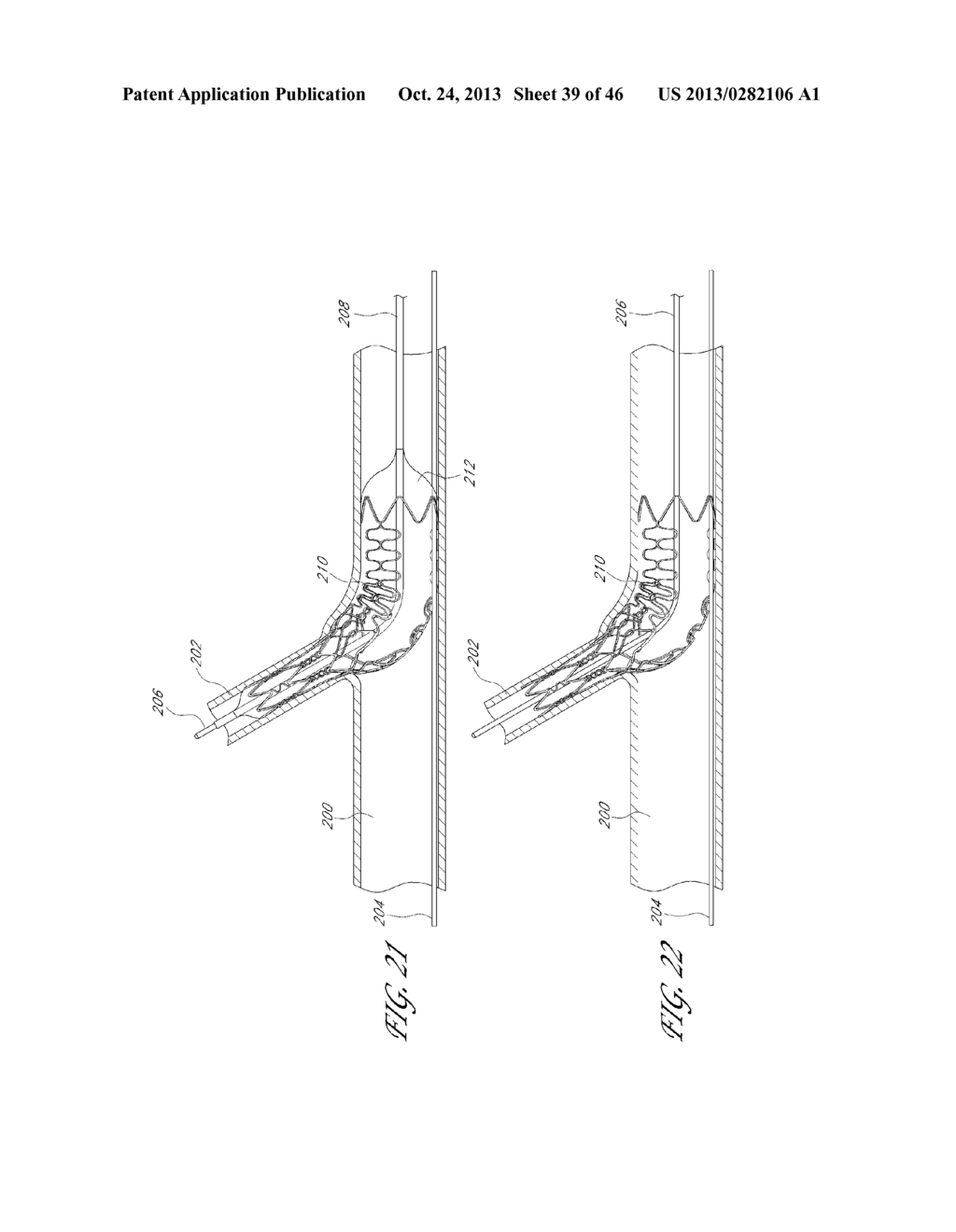 SUPPORT FOR TREATING VASCULAR BIFURCATIONS - diagram, schematic, and image 40