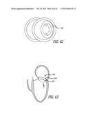 VALVE REPLACEMENT SYSTEMS AND METHODS diagram and image