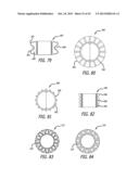 VALVE REPLACEMENT SYSTEMS AND METHODS diagram and image