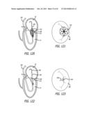 VALVE REPLACEMENT SYSTEMS AND METHODS diagram and image