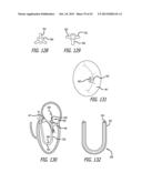 VALVE REPLACEMENT SYSTEMS AND METHODS diagram and image