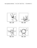 VALVE REPLACEMENT SYSTEMS AND METHODS diagram and image