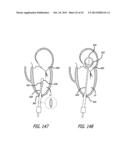 VALVE REPLACEMENT SYSTEMS AND METHODS diagram and image