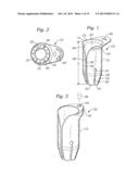 METHODS OF IMPLANTING A PROSTHETIC HEART VALVE diagram and image