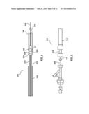 Valve Prosthesis diagram and image