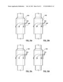 Valve Prosthesis diagram and image