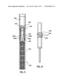 Valve Prosthesis diagram and image