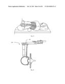 INTERBODY FUSION IMPLANT AND RELATED METHODS diagram and image