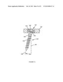 SPINAL IMPLANT SYSTEM AND METHOD diagram and image