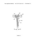 SPINAL IMPLANT SYSTEM AND METHOD diagram and image