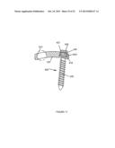 SPINAL IMPLANT SYSTEM AND METHOD diagram and image