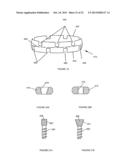 SPINAL IMPLANT SYSTEM AND METHOD diagram and image