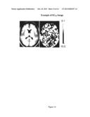 NOVEL METHODS FOR MEDICINAL DOSAGE DETERMINATION AND DIAGNOSIS diagram and image