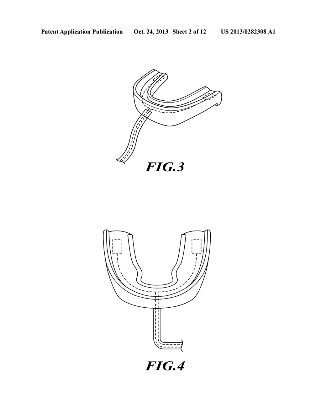 HEAD IMPACT EVENT REPORTING SYSTEM - diagram, schematic, and image 03