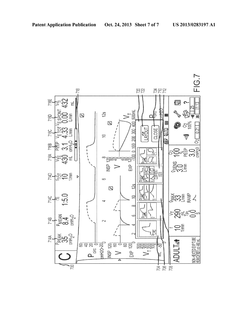 DISPLAY OF RESPIRATORY DATA GRAPHS ON A VENTILATOR GRAPHICAL USER     INTERFACE - diagram, schematic, and image 08