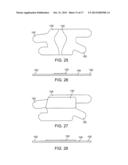 Adjustable Elastic Profile Compression Garment diagram and image