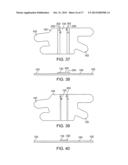 Adjustable Elastic Profile Compression Garment diagram and image