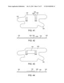 Adjustable Elastic Profile Compression Garment diagram and image