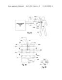 METHODS AND APPARATUS FOR LEAK DETECTION IN BLOOD PROCESSING SYSTEMS diagram and image