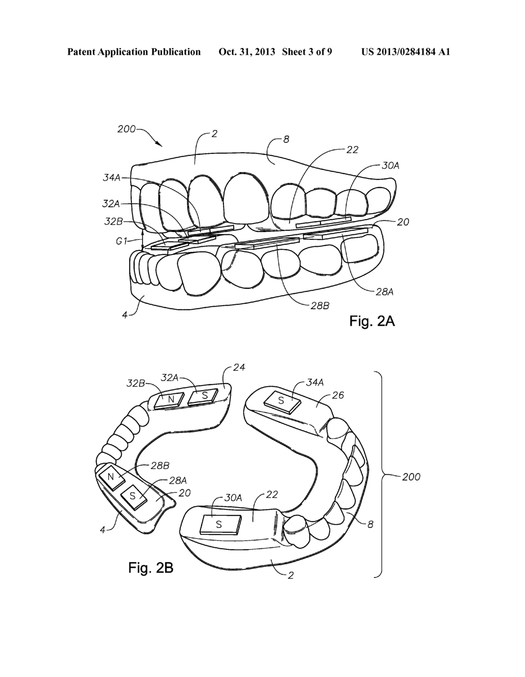 ORAL DEVICES, KITS, AND METHODS FOR REDUCING SLEEP APNEA, SNORING, AND/OR     NASAL DRAINAGE - diagram, schematic, and image 04