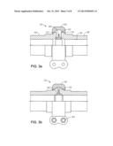 Delivery System for Fracture Applications diagram and image