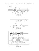 PACKAGE FOR A DENTAL MATERIAL AND A METHOD OF MANUFACTURING THE PACKAGE diagram and image