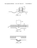 PACKAGE FOR A DENTAL MATERIAL AND A METHOD OF MANUFACTURING THE PACKAGE diagram and image