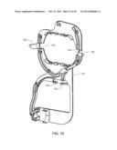 ENCLOSURE FOR A PORTABLE HEMODIALYSIS SYSTEM diagram and image