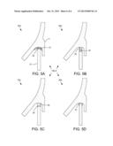 PRESSURE VESSEL SKIRT FOR ACCOMMODATING THERMAL CYCLING diagram and image